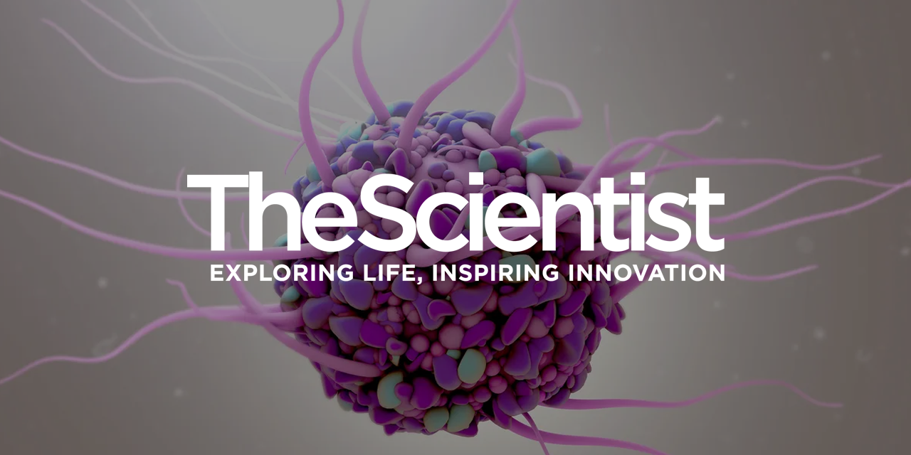 Patient-Derived Dendritic Cell Immunotherapy Targets Difficult-to-Treat Cancers